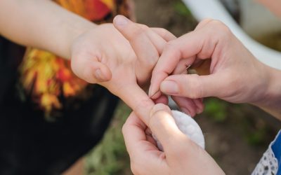 Comment s’y prendre pour enlever une écharde ?