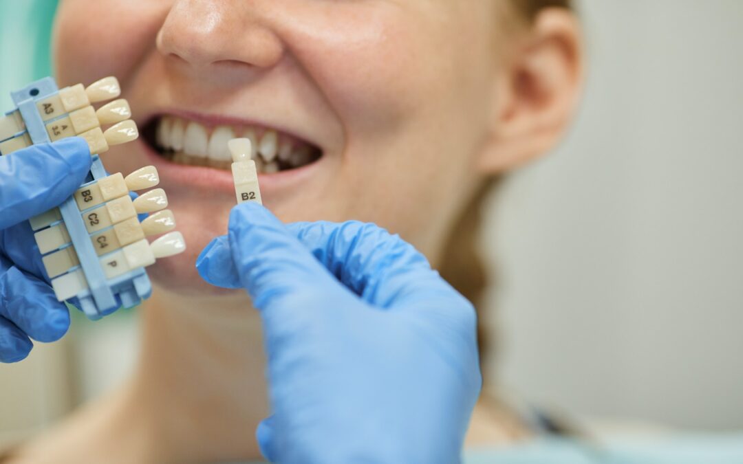 La prothèse sur implant : comment choisir la bonne prothèse ?